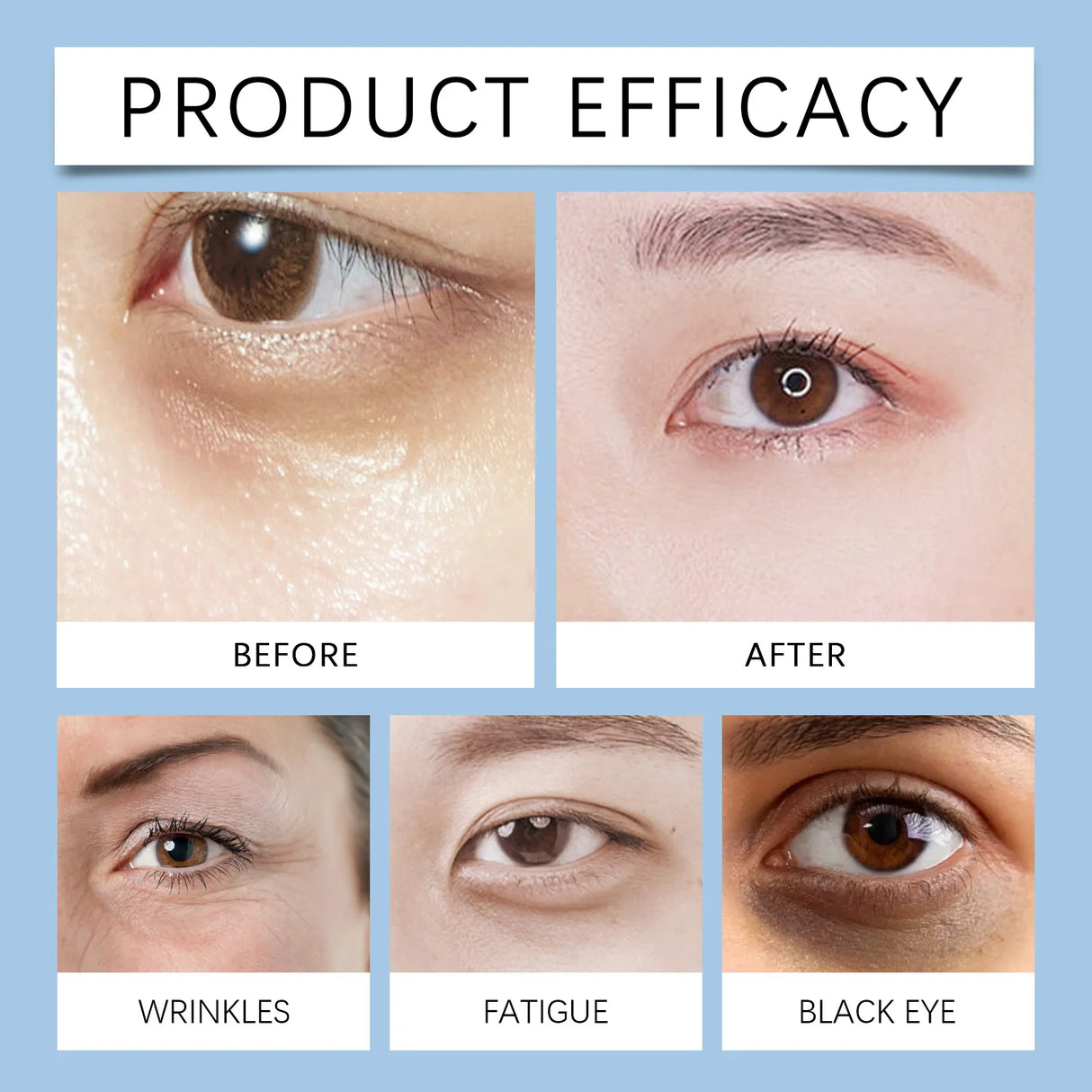 Hydrating Eye Cream,Fade Dark Circles Powerfully,Collagen Smooths Crow Feet,Deeply Hydrate & Lock Moisture,Anti Aging Against Photoaging,De Puffs & Refreshes Tired Eyes,Milia Free Lightweight Texture,Vegan & Cruelty Free
