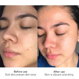 AILKE Face Cream With Hyaluron Scars Whitening Moisturizing Lifting Anti-aging Women Sleeping Dry Korean Bleaching Skin Care