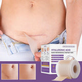 Surgical Soft Silicone Gel Scar Sheet Patch Treatmen Removal Tape Acne Trauma Burn Scar Cover Skin Repair Section Ear Beauty