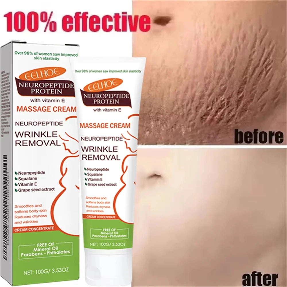 100g Stretch Marks Permanent Removal Cream Maternity Pregnant Women Pregnancy Anti-Winkle Smooth Repair Firming Skin Body Care