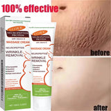 100g Stretch Marks Permanent Removal Cream Maternity Pregnant Women Pregnancy Anti-Winkle Smooth Repair Firming Skin Body Care