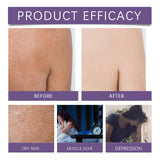 Lavender Essential Oil Moisturizes And Nourishes The Skin Relieves Anxiety Improves Sleep Quality & Is A Body Care Essential Oil