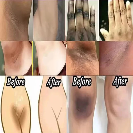 Whitening Cream For Dark Skin Underarm Bleaching Armpit Lightening And Intimate Area Woman Moisturizer Korean Skin Care Products