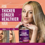Biotin Collagen Hair Growth Supplement with Vitamins A C D3 E B12 Zinc Supports hair wellness appearance for Women