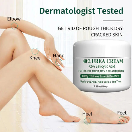 Urea Hand and Foot Cream Softens And Moisturizes Skin Relieves Dryness Repairs Cracks Exfoliates Dead Body Skin Moisturizing