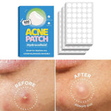 Crescent-shaped Acne Patches Invisible Pimple Cover For Face Oil Control Spot Treatment Sticker For Covering Zits And Blemishes