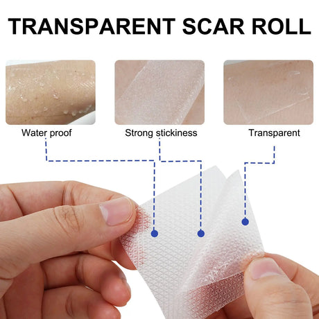 1 Roll Invisible Silicone Scar Sheets , 4cm X 150/300cm Self-Adhesive Scar Cover Tape Reusable and Effective Skin Care Strips