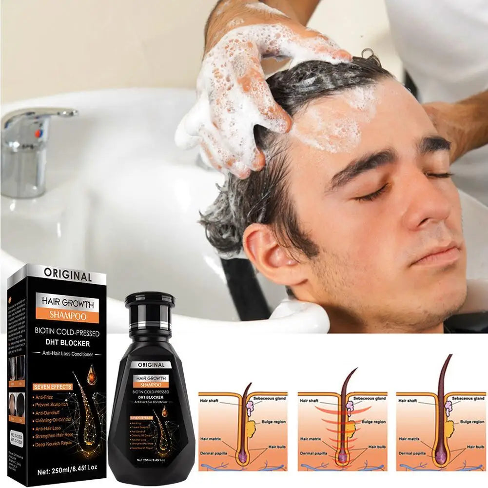 250ML Biotin Shampoo For Hair Growth And Thinning Hair – Ginger Shampoo Thickening Formula For Hair Loss Treatment For Women Men