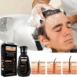 250ML Biotin Shampoo For Hair Growth And Thinning Hair – Ginger Shampoo Thickening Formula For Hair Loss Treatment For Women Men