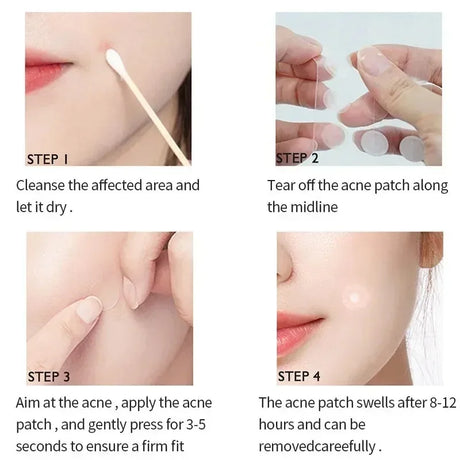 LANBENA Repair Acne Patch Facial Skin Care Fade Blemishes Pimple Marks Closed Acne Blemishes Cover Acne Pimple Repair Patch