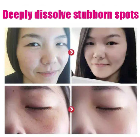 Korean Cosmetics Epidermal Growth Factor EGF Serum Acne Scar Wrinkle Removal Spots Repair Firming Face Care Without Box