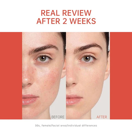 PDRN Salmon DNA Serum Ampoule Repair Renew Skin Brighten Tone Facial Essence Hydrating Nourishing Firming Skin Care Treatment