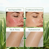 YUVK Aloe Vera Gel for Hydration and Moisture 300G
