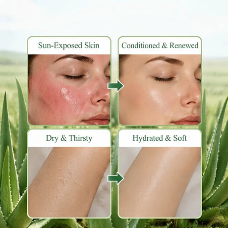 YUVK Aloe Vera Gel for Hydration and Moisture 300G