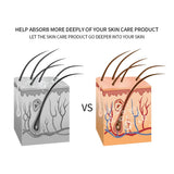 5 In 1 Home Facial Beauty Device Mesotherapy Electroporation RF Radio Frequency Facial LED Photon Skin Care Beauty Device Face Lifting Tighten