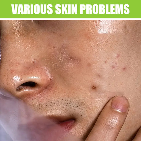 Men's Facial Wash 60g - Green Tea & Salicylic Acid, Deep Cleansing, Oil Control, Tea Tree & Charcoal, For Men
