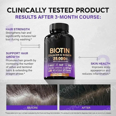 Biotin Capsules Contain Collagen and Vitamin B2, B3, B6 & B7 for Women Men Hair Care Supplements Skin & Nails Support 60 Pieces