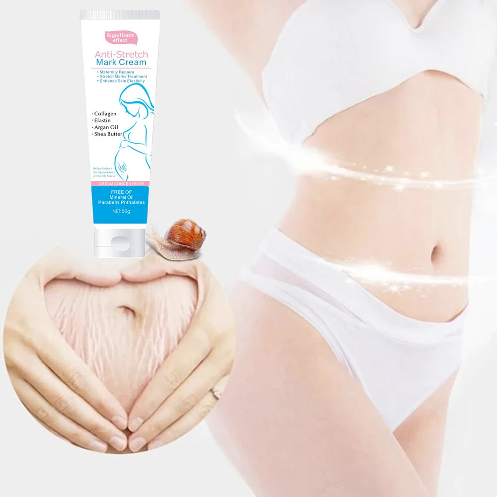 Snail Removes Stretch Mark Cream To Remove Postpartum Obesity Pregnant Women Repair Anti-Aging Anti-Winkles Firming Body Cream