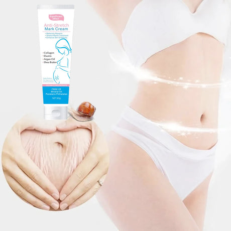 Snail Removes Stretch Mark Cream To Remove Postpartum Obesity Pregnant Women Repair Anti-Aging Anti-Winkles Firming Body Cream