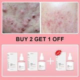 Collagen Peptide Facial Serum Targets Dull Skin Boosts Skin Elasticity Stimulates Skin Renewal Repair Salmon PDRN KOREAN Product