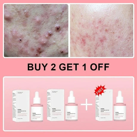 Collagen Peptide Facial Serum Targets Dull Skin Boosts Skin Elasticity Stimulates Skin Renewal Repair Salmon PDRN KOREAN Product