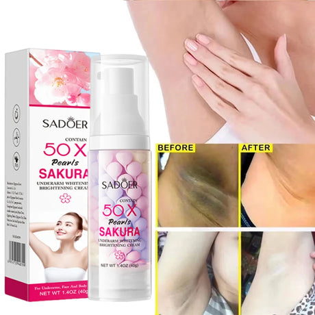 Whitening Cream Private Parts Underarm Bleaching Serum Whiten Butt Knee Brighten Inner Thigh Intimate Parts Dark Remove Melanin