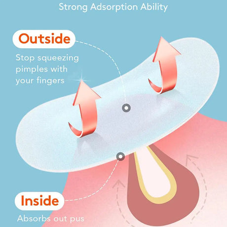Crescent-shaped Acne Patches Invisible Pimple Cover For Face Oil Control Spot Treatment Sticker For Covering Zits And Blemishes