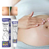 Stretch Marks Permanent Removal Cream Maternity Pregnant Women Pregnancy Anti-Winkle Smooth Repair Firming Skin Body Skin Care
