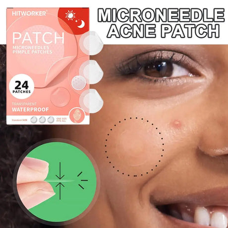 24PCS Microneedle AcnePatch Painlessly Penetrate Acne Patches Blemishes Pimples Covering Patch Daily Unisex Skincare