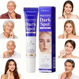 1/2/3PCS Dark Spots Removal Cream Facial Whitening Freckle Acne Mark Pigmentation Removal Melanin Skin Correction Care