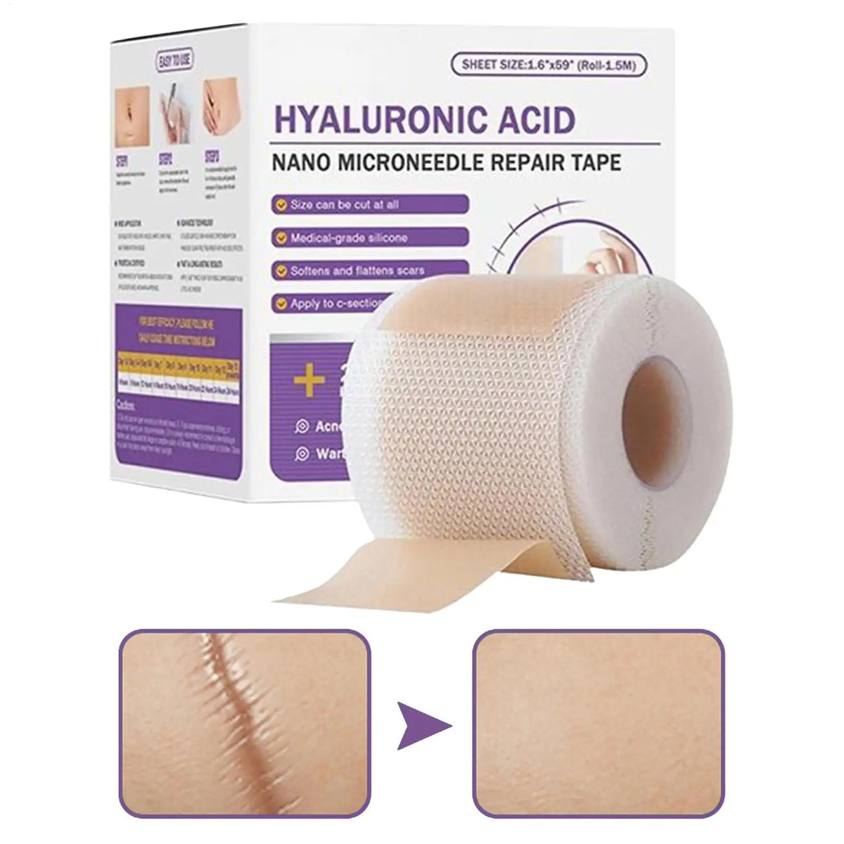 Surgical Soft Silicone Gel Scar Sheet Patch Treatmen Removal Tape Acne Trauma Burn Scar Cover Skin Repair Section Ear Beauty