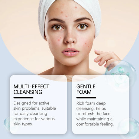 Salicylic Acid Facial Cleanser Acne Treatment Moisturizing Oil Control Skincare Face Wash Cleansing Pore Hydrating Skin Care