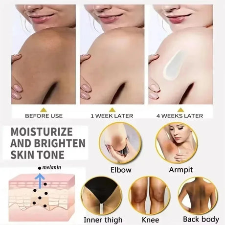 Body Whitening Cream Private Parts Underarm Bleaching Serum Whiten Butt Knee Brighten Inner Thigh Intimate Dark Remove Melanin