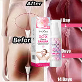 Whitening Cream Private Parts Underarm Bleaching Serum Whiten Butt Knee Brighten Inner Thigh Intimate Parts Dark Remove Melanin