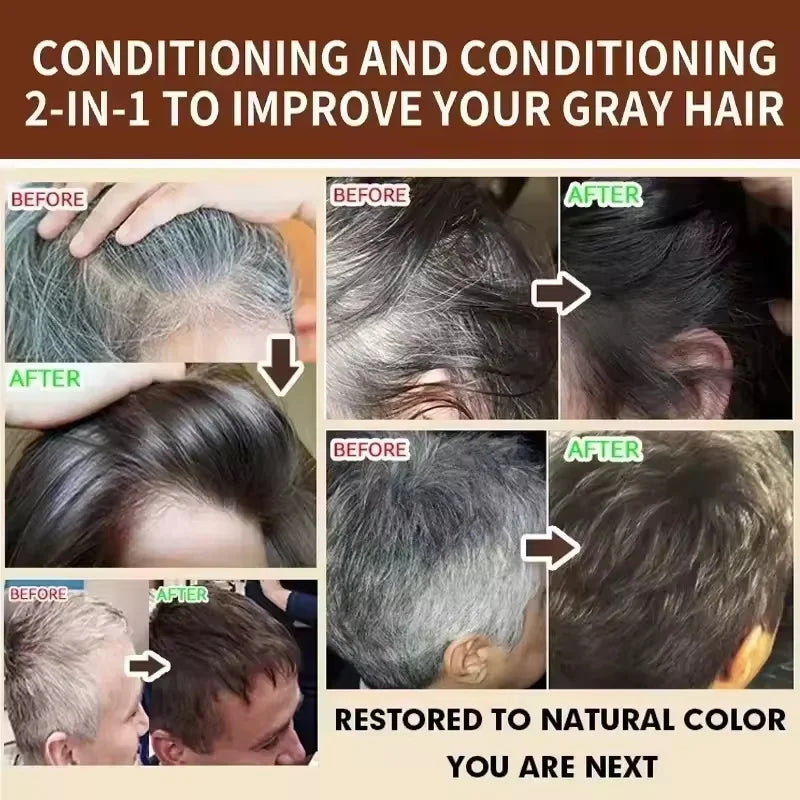 Gray White Hair Treatment Shampoo White To Black Anti Gray Hair Beard Dye Anti Loss Repair Nourish Hair Care Products Men Women
