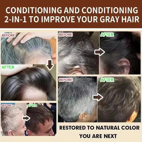 Gray White Hair Treatment Shampoo White To Black Anti Gray Hair Beard Dye Anti Loss Repair Nourish Hair Care Products Men Women