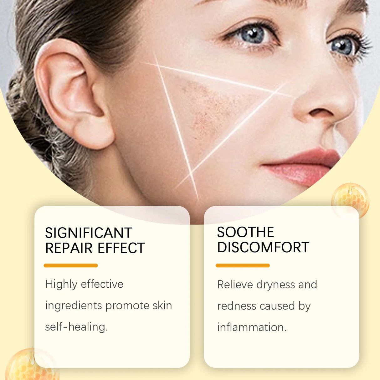 Bee Venom Skin Treatment Cream Skin Blemish Remover Moisturizing Skin Elasticity Increased Smooth Body Care Bee Venom Cream 60g