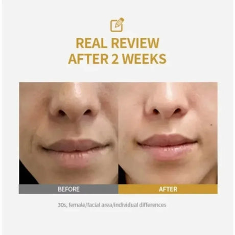 Silk Protein Deep Collagen Ampoule Set Anti Wrinkle Lifting Serum Skin Elasticity Boost Daily Facial Repair Essence