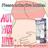 Gentle Skin Care Improves Elasticity Effective After Pregnancy Stretch Marks Removal Powerful Maternity Cream Nourishes Skin