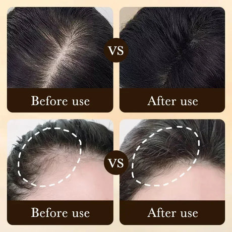 Biotin fast Hair Growth oil Products Care Scalp Massage Treatments Anti Hair Loss Effective Grow Thicker Hair serum for men