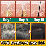 Gray White Hair Treatment Shampoo White To Black Anti Gray Hair Beard Dye Anti Loss Repair Nourish Hair Care Products Men Women