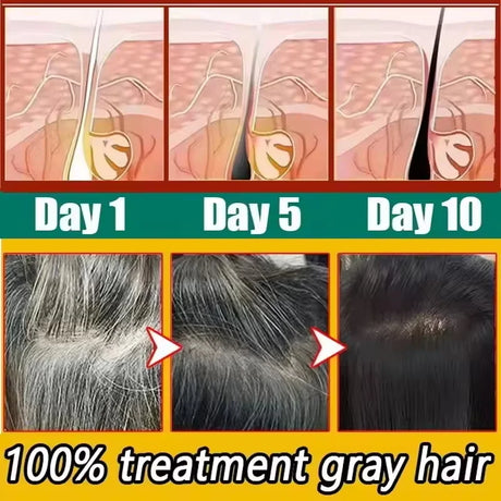 Gray White Hair Treatment Shampoo White To Black Anti Gray Hair Beard Dye Anti Loss Repair Nourish Hair Care Products Men Women
