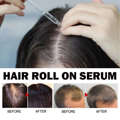 Eelhoe Jojoba Oil Hair Growth Serum Reduce Loss Scalp Treatment More Thicker Keep Regrowth Oil Control Hair Nourish Essencial Oi