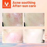 Repair Aloe Vera Gel Moisturizing Skin Care Natural Plant Extracts Ance Treatment Mild Soothing Face Care Day Cream Nourish 100G