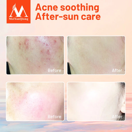 Repair Aloe Vera Gel Moisturizing Skin Care Natural Plant Extracts Ance Treatment Mild Soothing Face Care Day Cream Nourish 100G