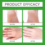 Hand and Foot Balm Stick with Beeswax for Dry Cracked Skin Soothing Repairing Rough Heels Hands Non Greasy Travel Size 30g