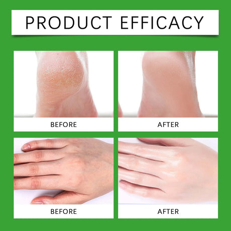 Hand and Foot Balm Stick with Beeswax for Dry Cracked Skin Soothing Repairing Rough Heels Hands Non Greasy Travel Size 30g