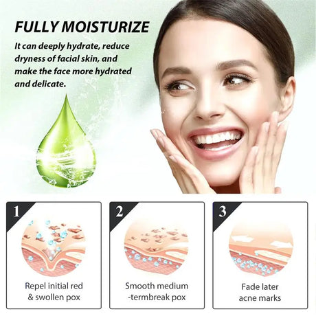 Natural Herbs Acid Acne Cream Shrink Pores Blackheads Scars Acne Marks Blemishes Oil Control Whitening Korean Skin Care Products