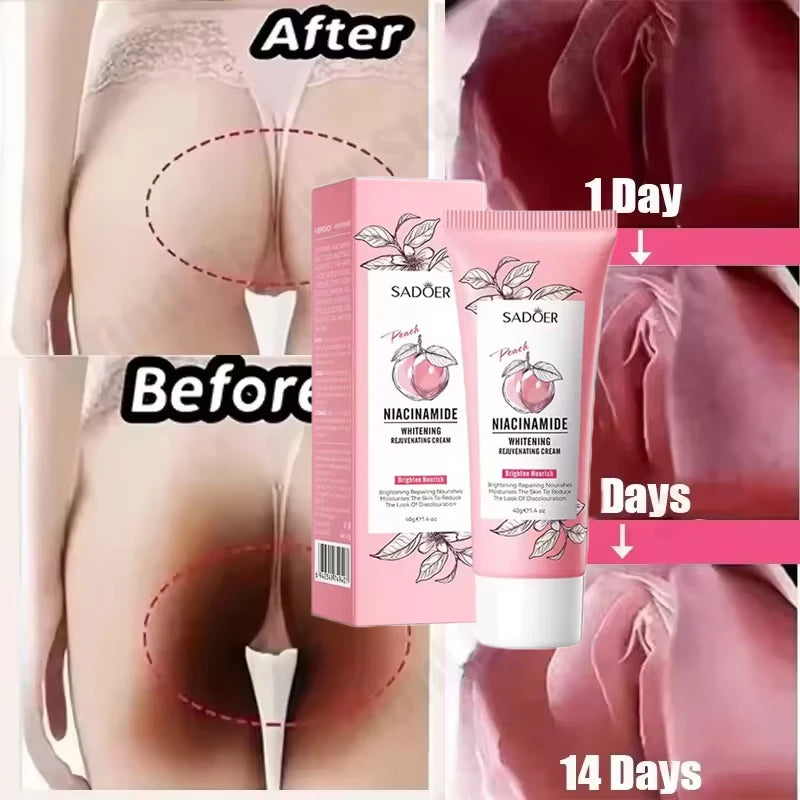 Body Whitening Cream Dark Skin Armpit Lightening Intimate Areas Underarm Bleaching Private Parts Whiten Cream Body Lotion Beauty