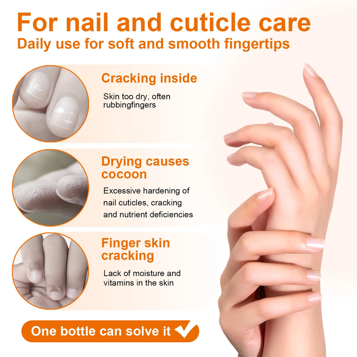 TWOING Honey Milk Cuticle Oil - 30ml Dropper Nail & Cuticle Moisturizer for Dry Skin And Thin Nails Nail Nutrition Oil